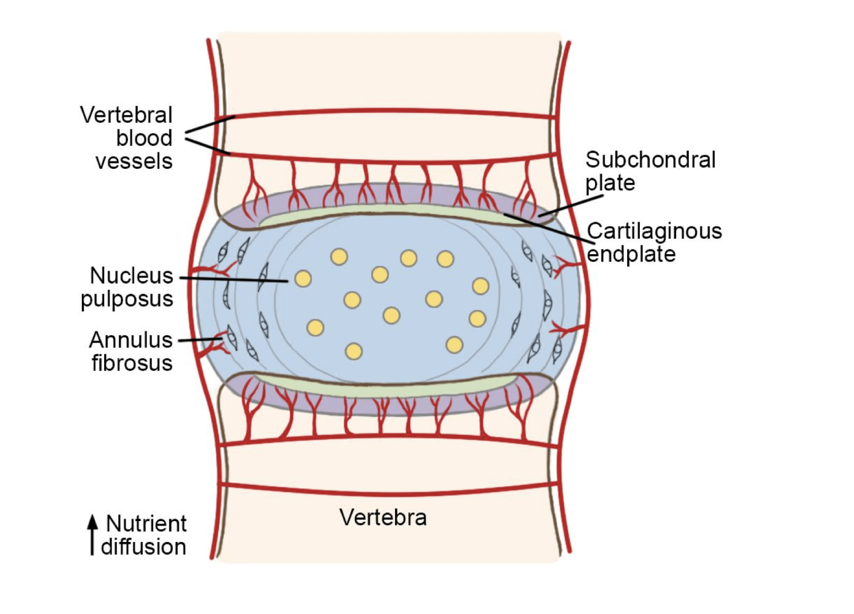 disc-herniation-4 Nerve Root Blocks