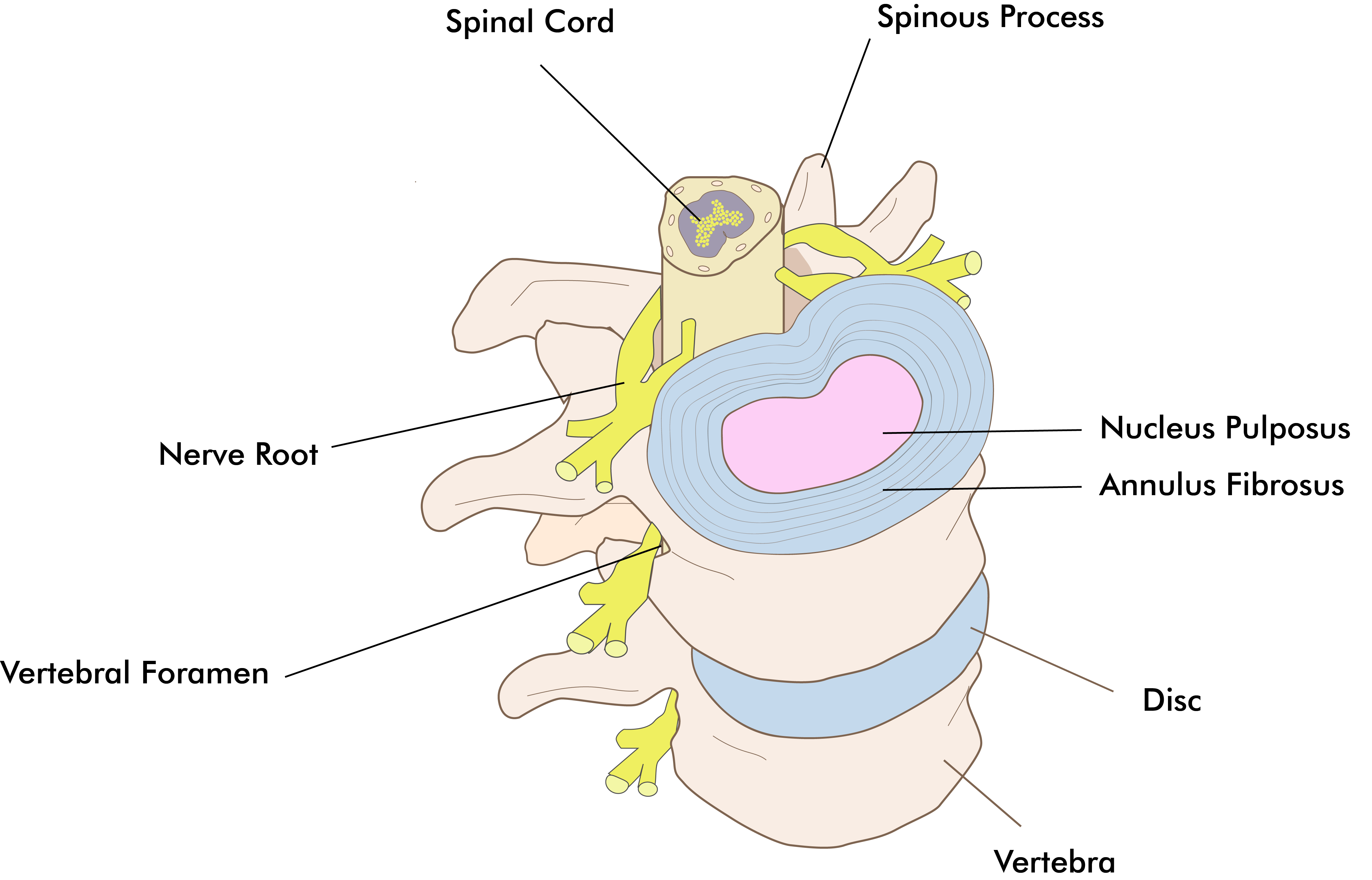 healthy-spine-1-01 Transforminal epidural x-ray