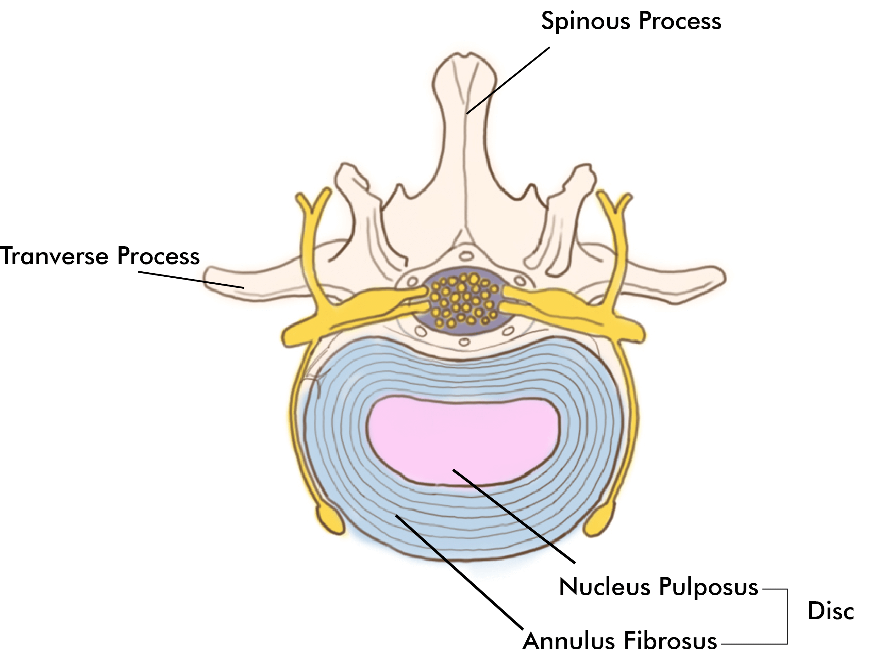 healthy-spine-2-01 Transforminal epidural x-ray