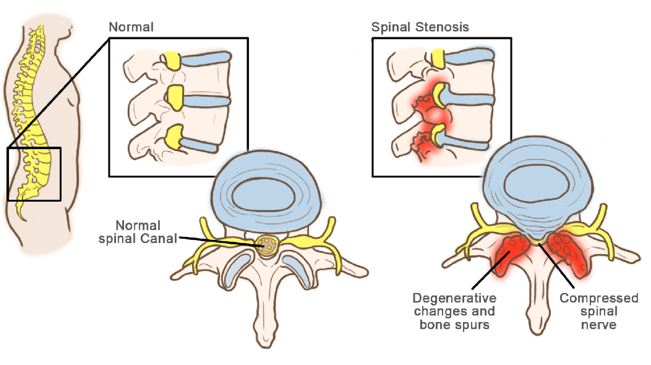 portfolio-3-15 Nerve Root Blocks