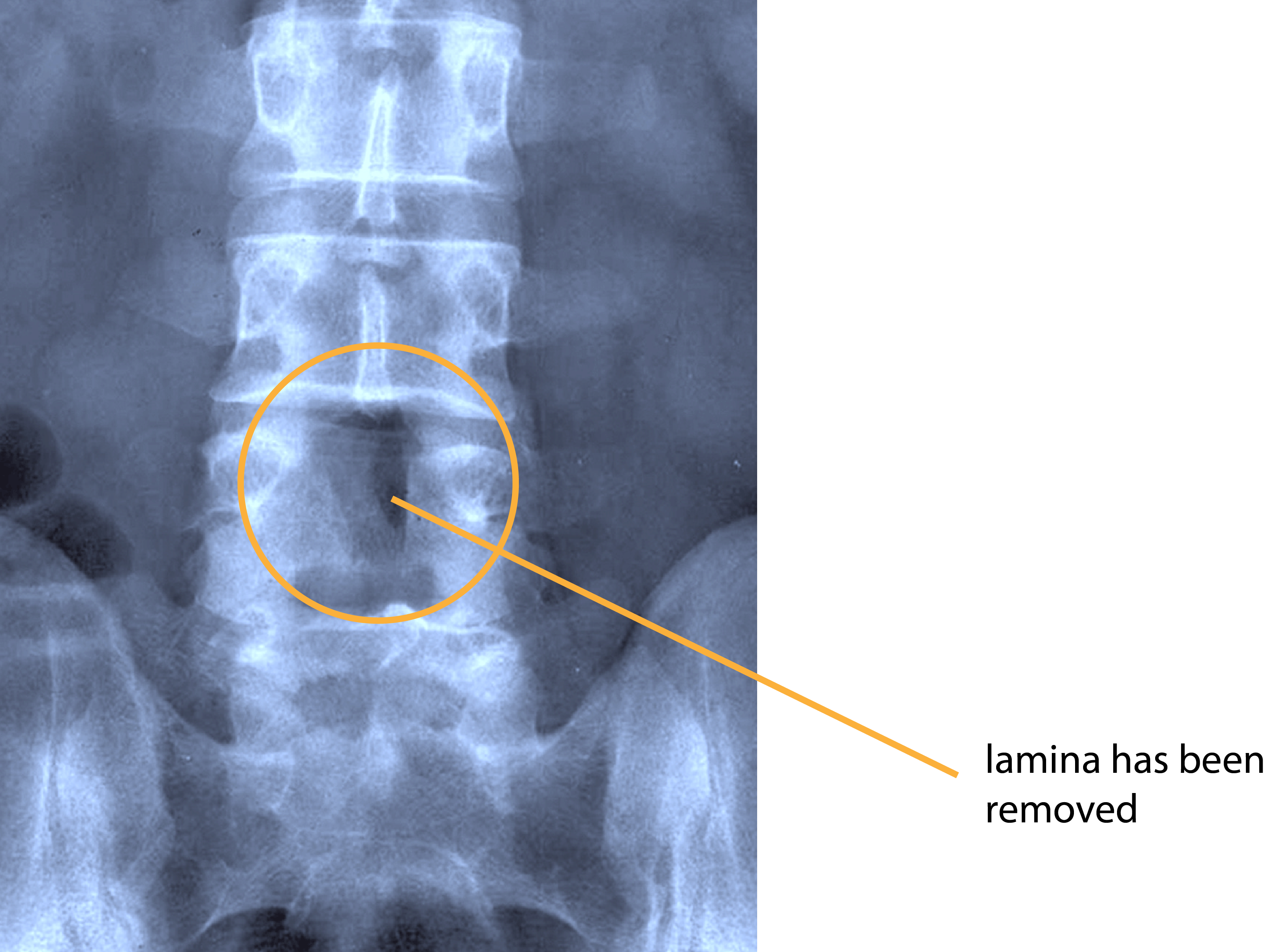 porfolio-2-10-02 Nerve Root Blocks